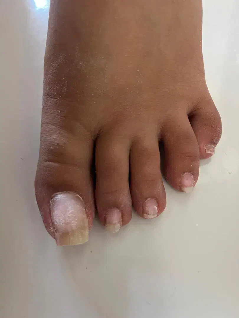 خدمات کاشت ناخن فقط با ۳۰۰ تومن|خدمات آرایشگری و زیبایی|چالوس, |دیوار