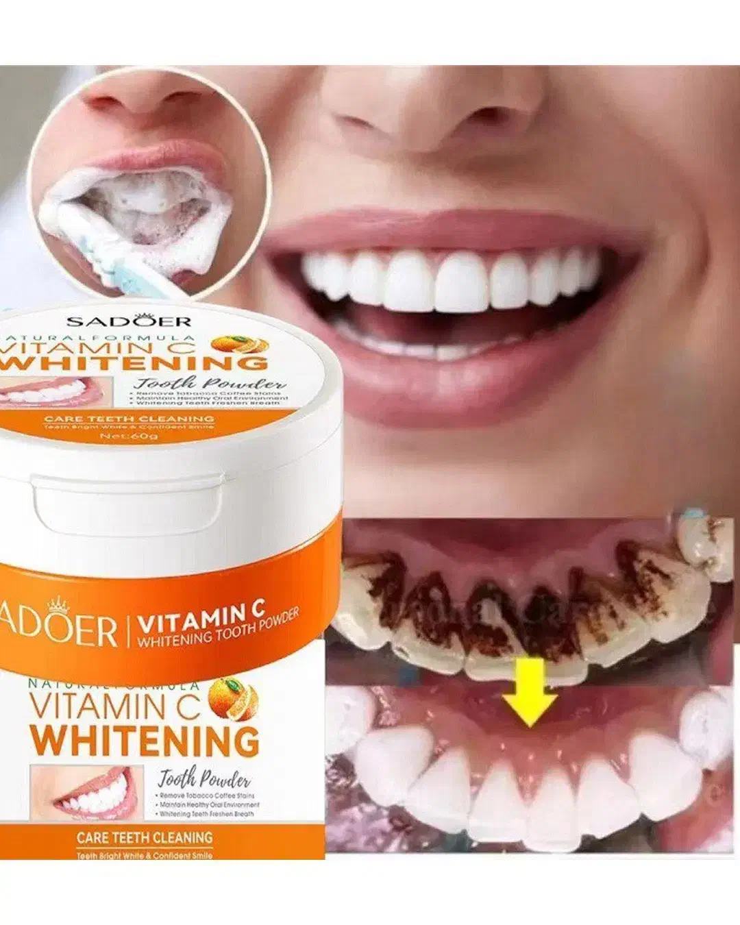 پودر سفیدکننده فوری دندان ویتامین C|آرایشی، بهداشتی، درمانی|منوجان, |دیوار