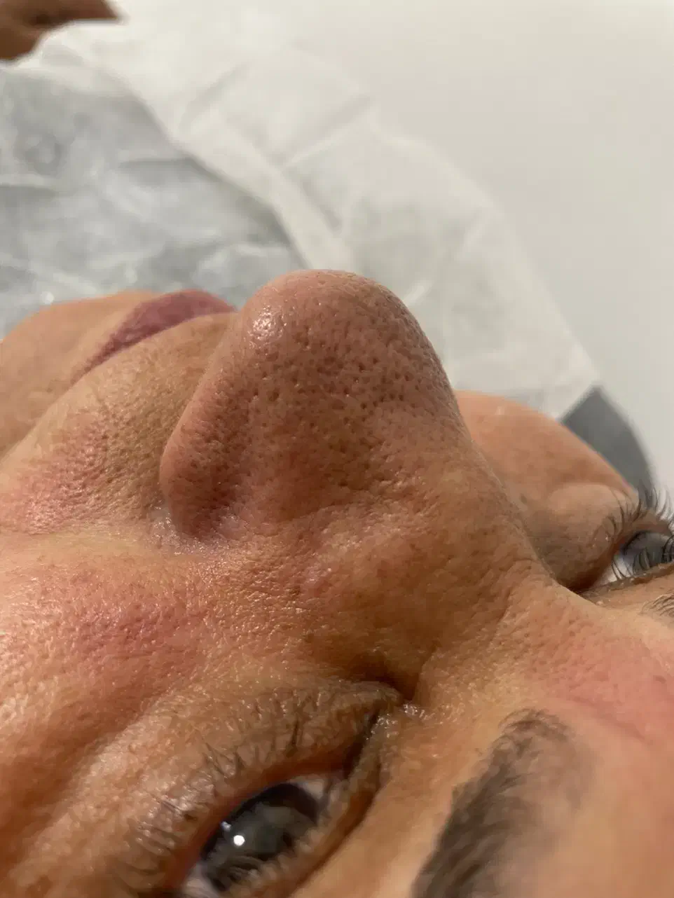 فیشیال،پاکسازی،درما پلنینگ|خدمات آرایشگری و زیبایی|بیرجند, |دیوار