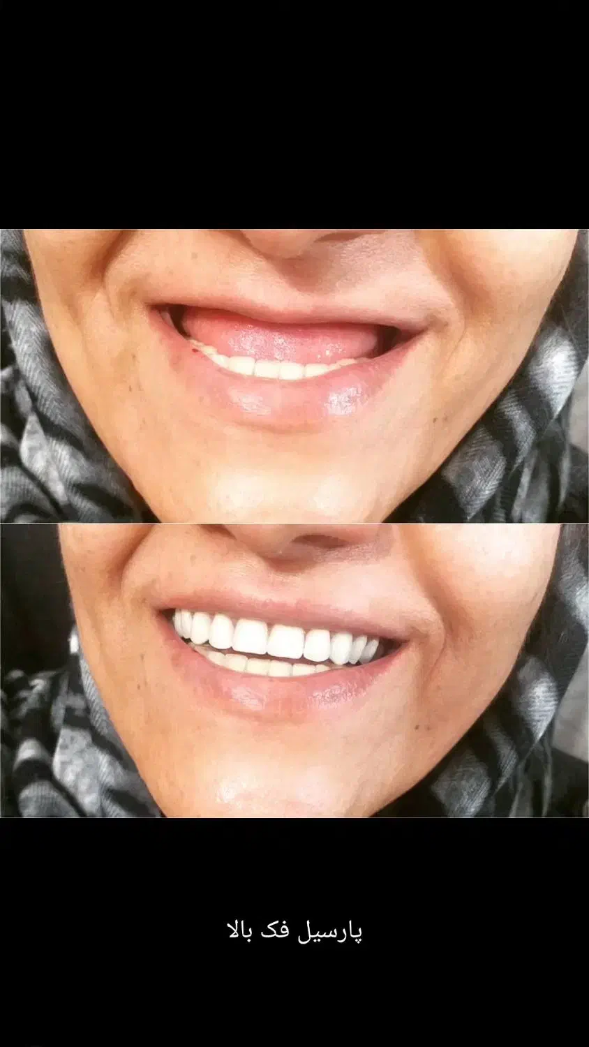 دندانسازی|پزشکی|مرودشت, فرهنگ|دیوار