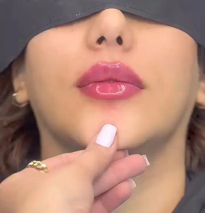 جشنواره ی ۵۰ درصد آف ویژه ی ژل بوتاکس توسط پزشک|خدمات آرایشگری و زیبایی|کرمانشاه, |دیوار