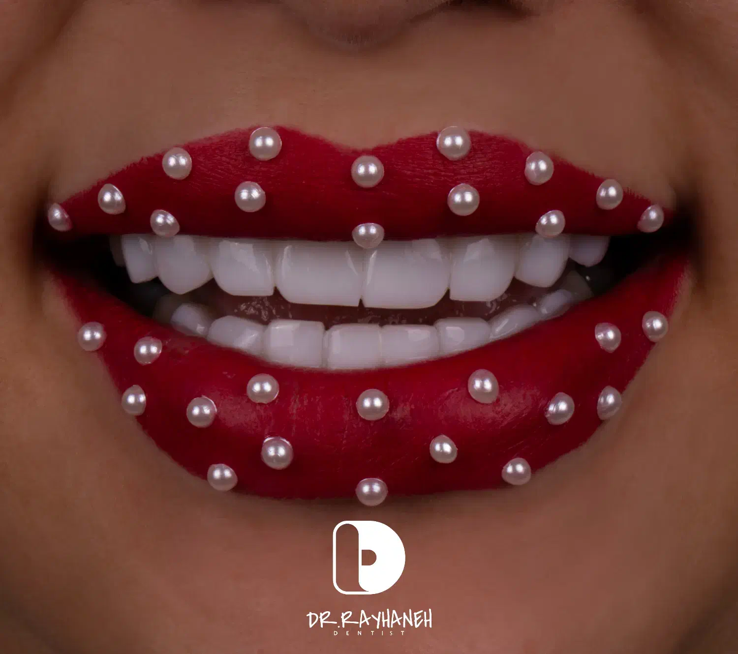 کامپوزیت/لمینت/دندانپزشکی|خدمات آرایشگری و زیبایی|مشهد, کوثر|دیوار