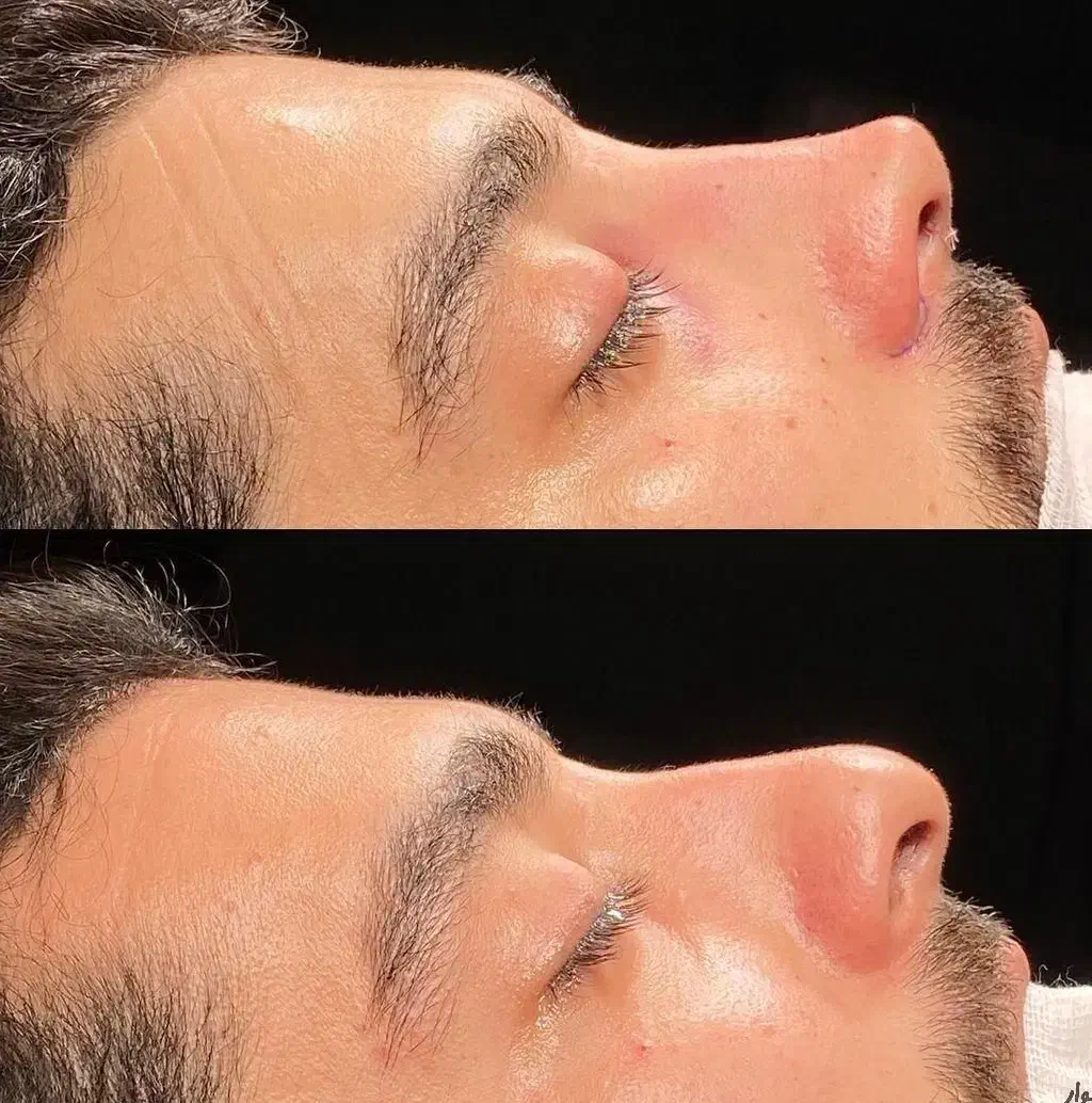 تخفیف عمل بینی لیپو ابدو لیفت ابرو وکاشت ابرو و مو|خدمات آرایشگری و زیبایی|اسلامشهر, شهرک لاله|دیوار