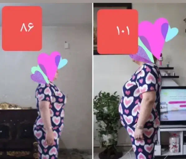 لاغری|آرایشی، بهداشتی، درمانی|کرمان, |دیوار