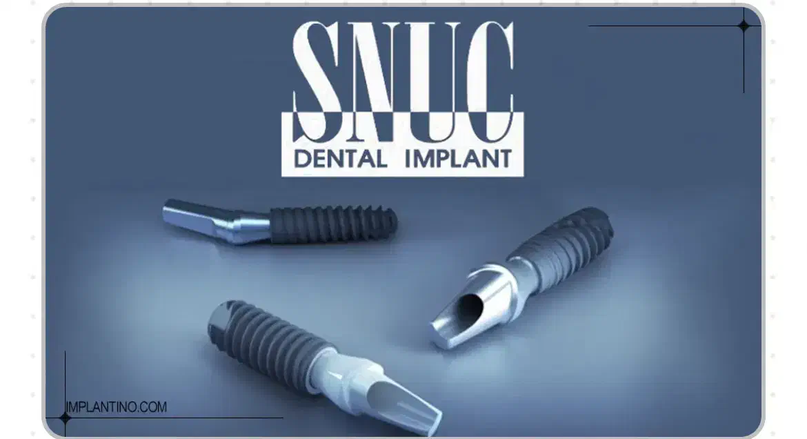 فروش فیکسچر دندانپزشکی اسنوکون و چاروم|پزشکی|تهران, آجودانیه|دیوار