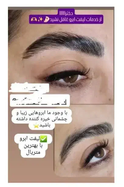 تخفیف لیزرکل بدن فقط۴۵۰ بمناسبت روزمادر تست رایگان|خدمات آرایشگری و زیبایی|زنجان, |دیوار