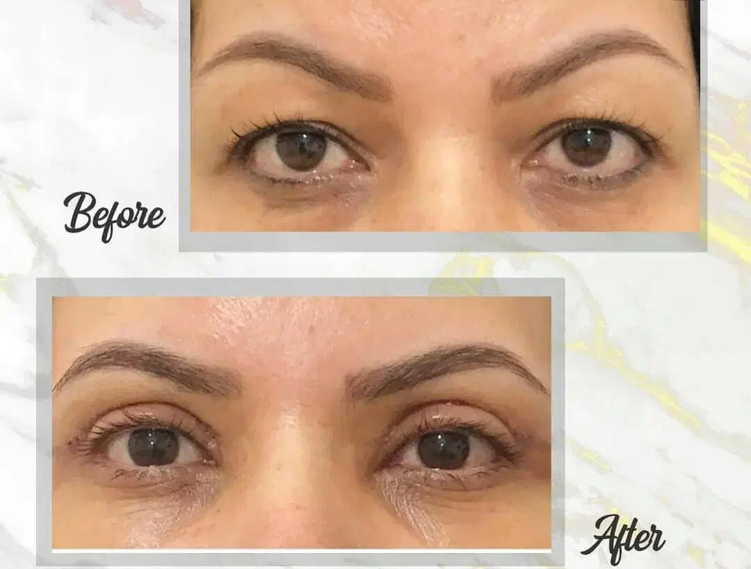 پزشک مسلط به جراحی بلفاروپلاستی|خدمات آرایشگری و زیبایی|تهران, سلسبیل شمالی|دیوار