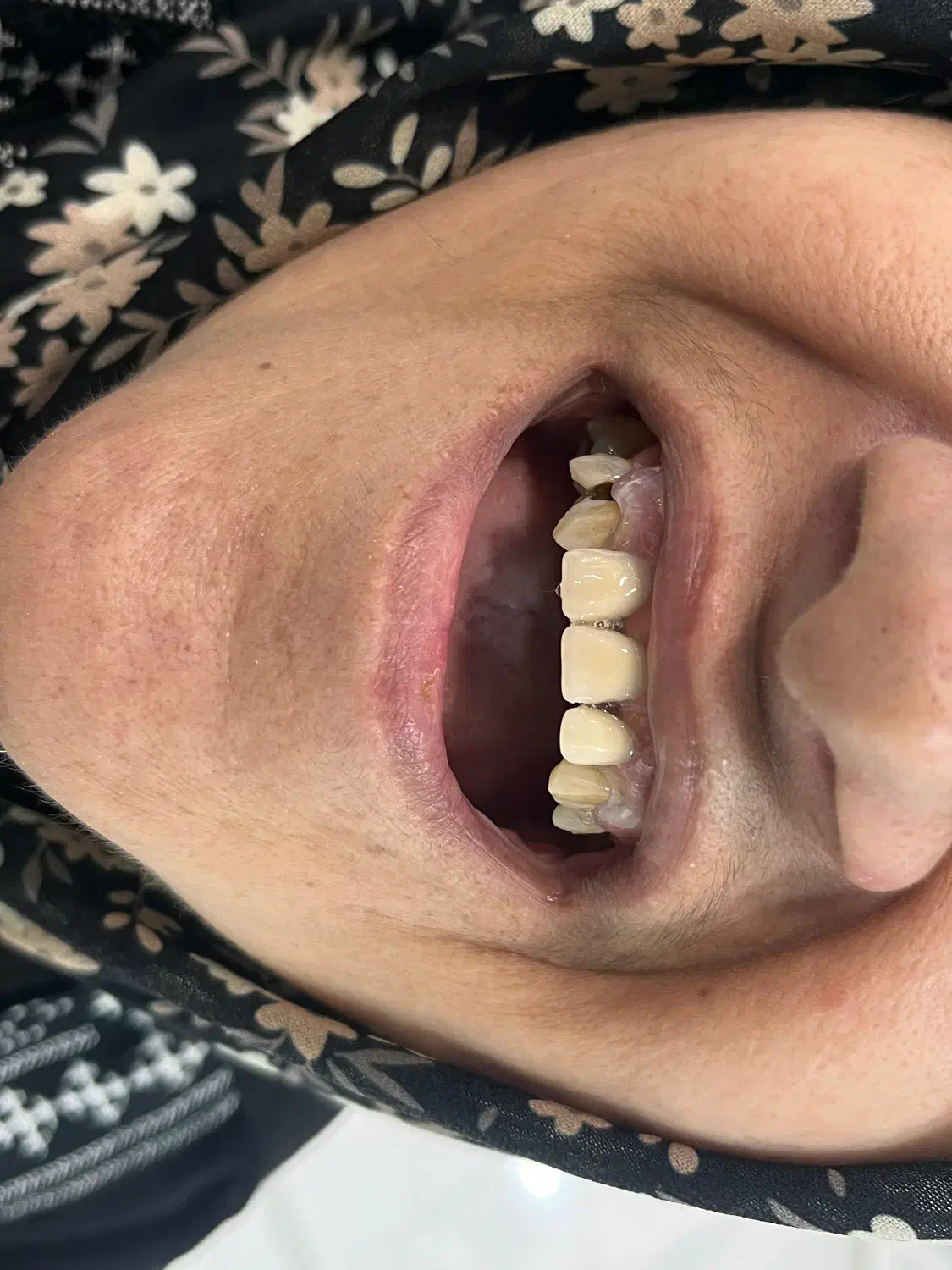 خدمات دندانسازی مروارید|خدمات آرایشگری و زیبایی|دهدشت, |دیوار