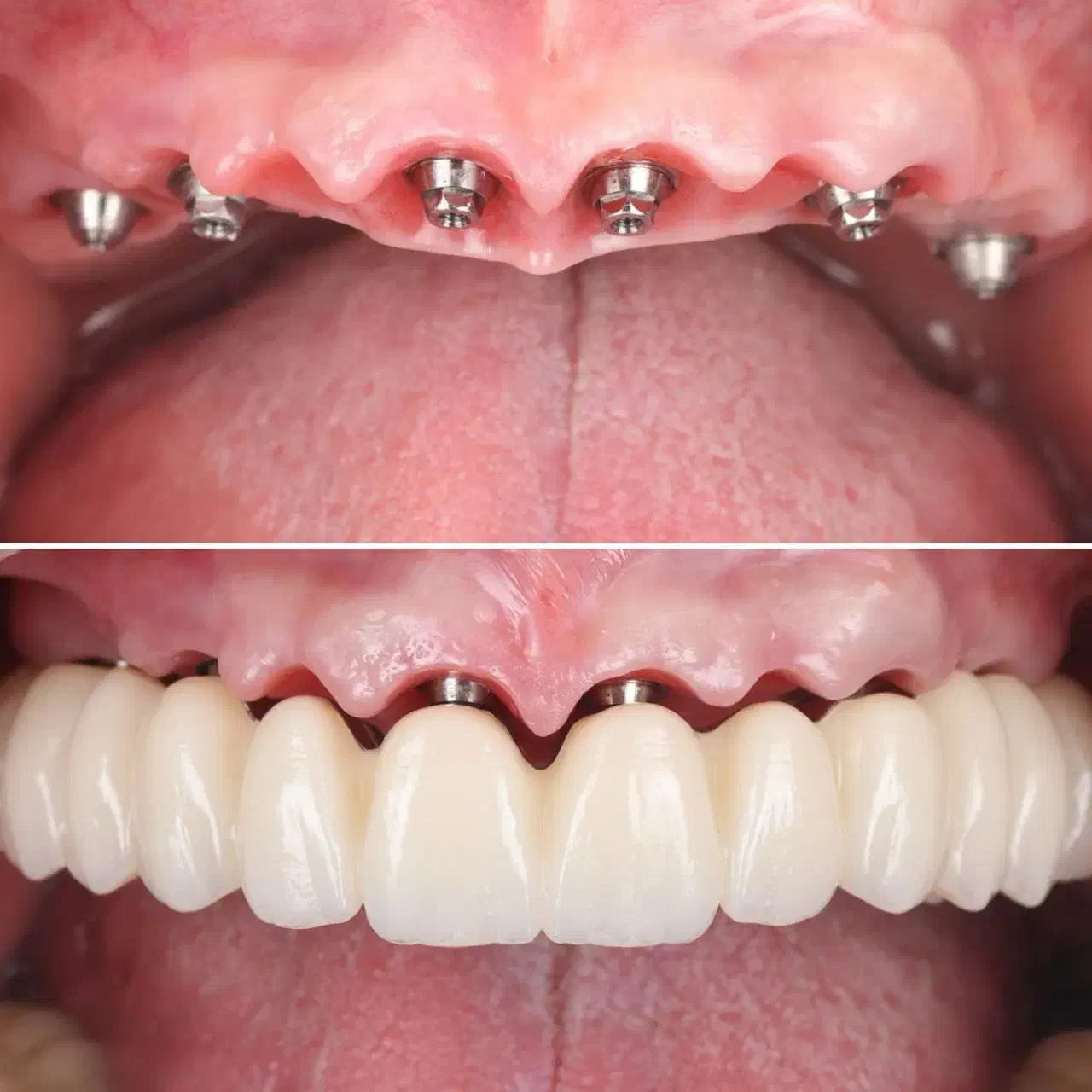 دندانپزشکی ایمپلنت دیجیتال و فوری با اقساط بلندمدت|خدمات آرایشگری و زیبایی|تبریز, |دیوار