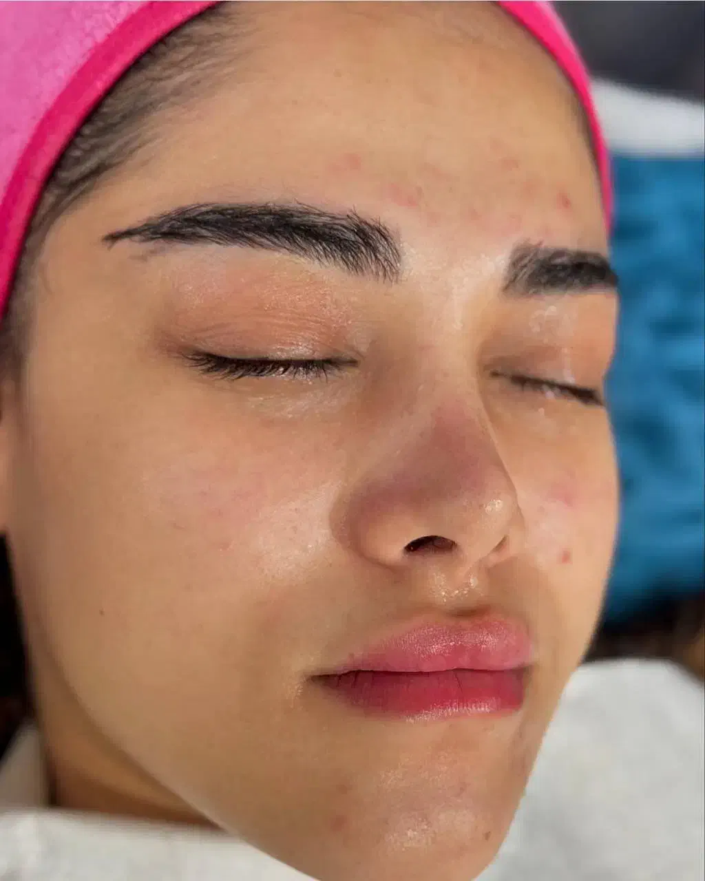 فیشال تخصصی زیر نظر پزشک|خدمات آرایشگری و زیبایی|مسجد سلیمان, |دیوار