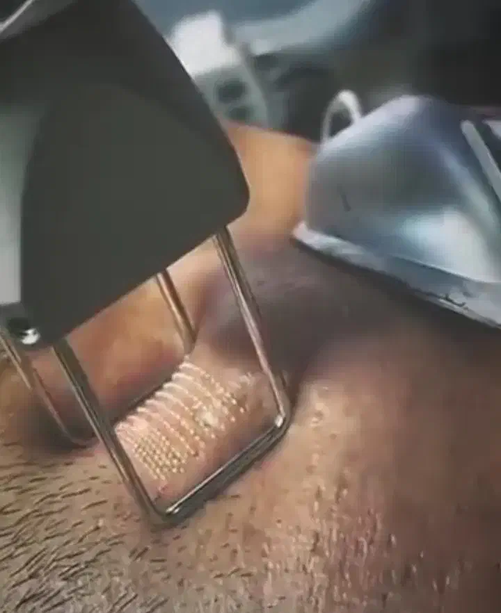 لیزر(خانم ها)۳۰۰لیزر(آقایان )۶۰۰و لیزر فوتونا۱۲۰۰|خدمات آرایشگری و زیبایی|نجفآباد, باغ ملی|دیوار