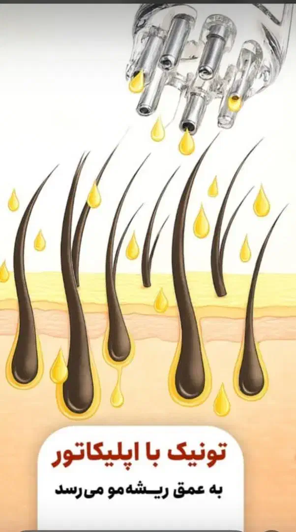 تونیک ضد ریزش و محرک رشد مجدد مو با اپلیکاتور|آرایشی، بهداشتی، درمانی|بابل, |دیوار