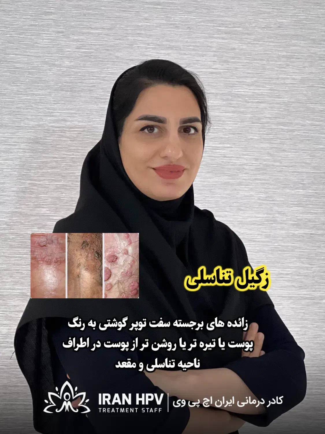 hpv وhsv|آرایشی، بهداشتی، درمانی|ساری, |دیوار