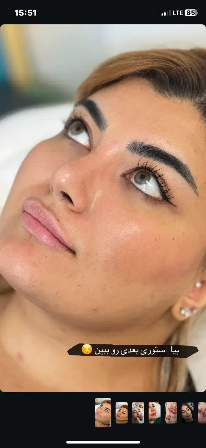 پروتزلب|خدمات آرایشگری و زیبایی|زابل, |دیوار