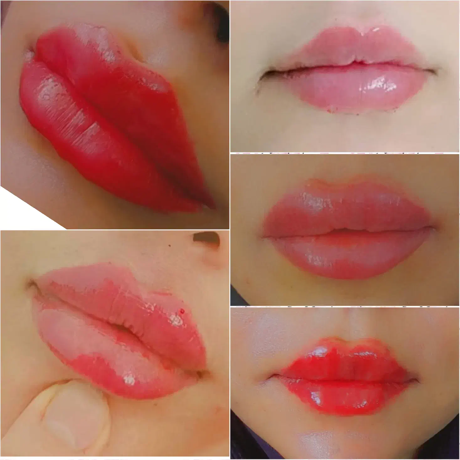 آموزش وارائه خدمات ژل و بوتاکس و فیلربادی(ژل بدن)|خدمات آرایشگری و زیبایی|جهرم, |دیوار