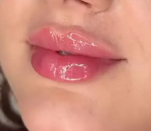 جشنواره پاییزه فیلر و بوتاکس با ۵۰ درصد تخفیف|خدمات آرایشگری و زیبایی|تهران, قیطریه|دیوار