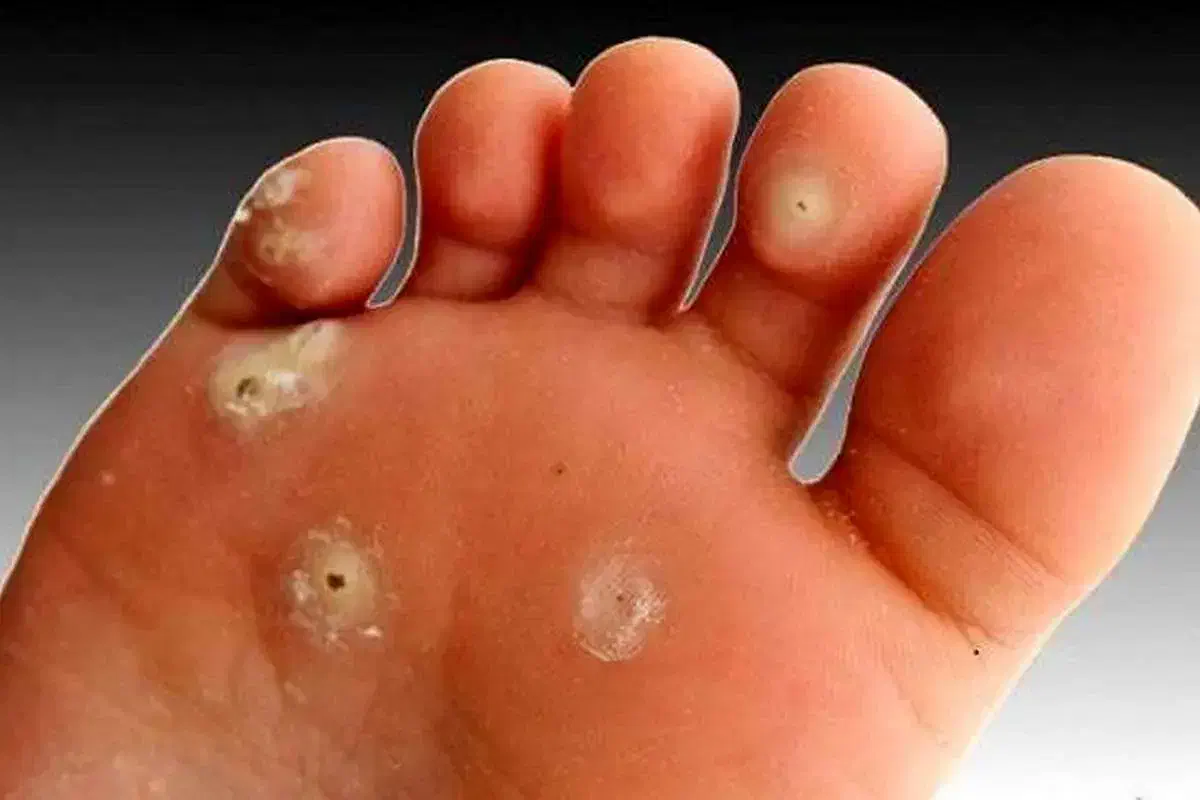 درمان|آرایشی، بهداشتی، درمانی|مشهد, کارمندان دوم|دیوار