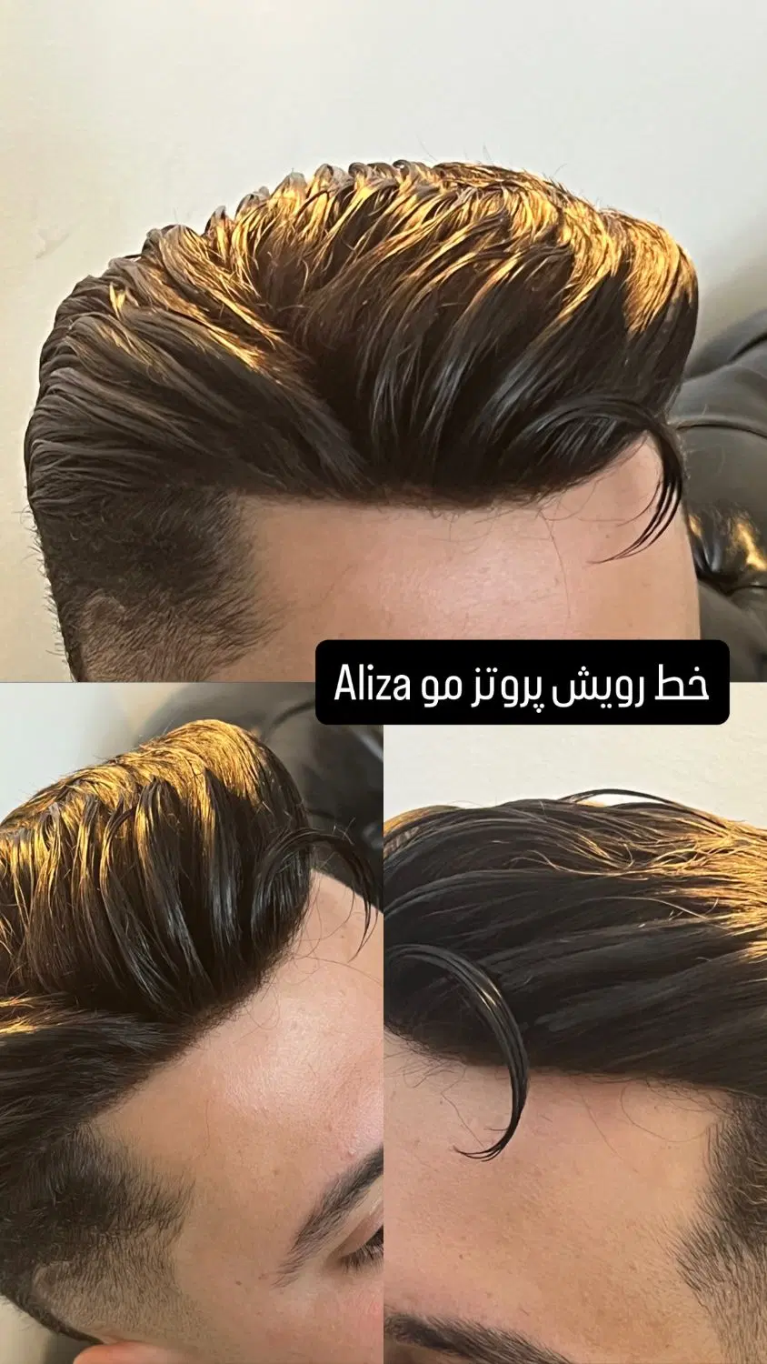 پروتز مو و چسب پروتز مو شیراز Aliza|خدمات زیبایی و سلامت|شیراز, ملاصدرا|دیوار