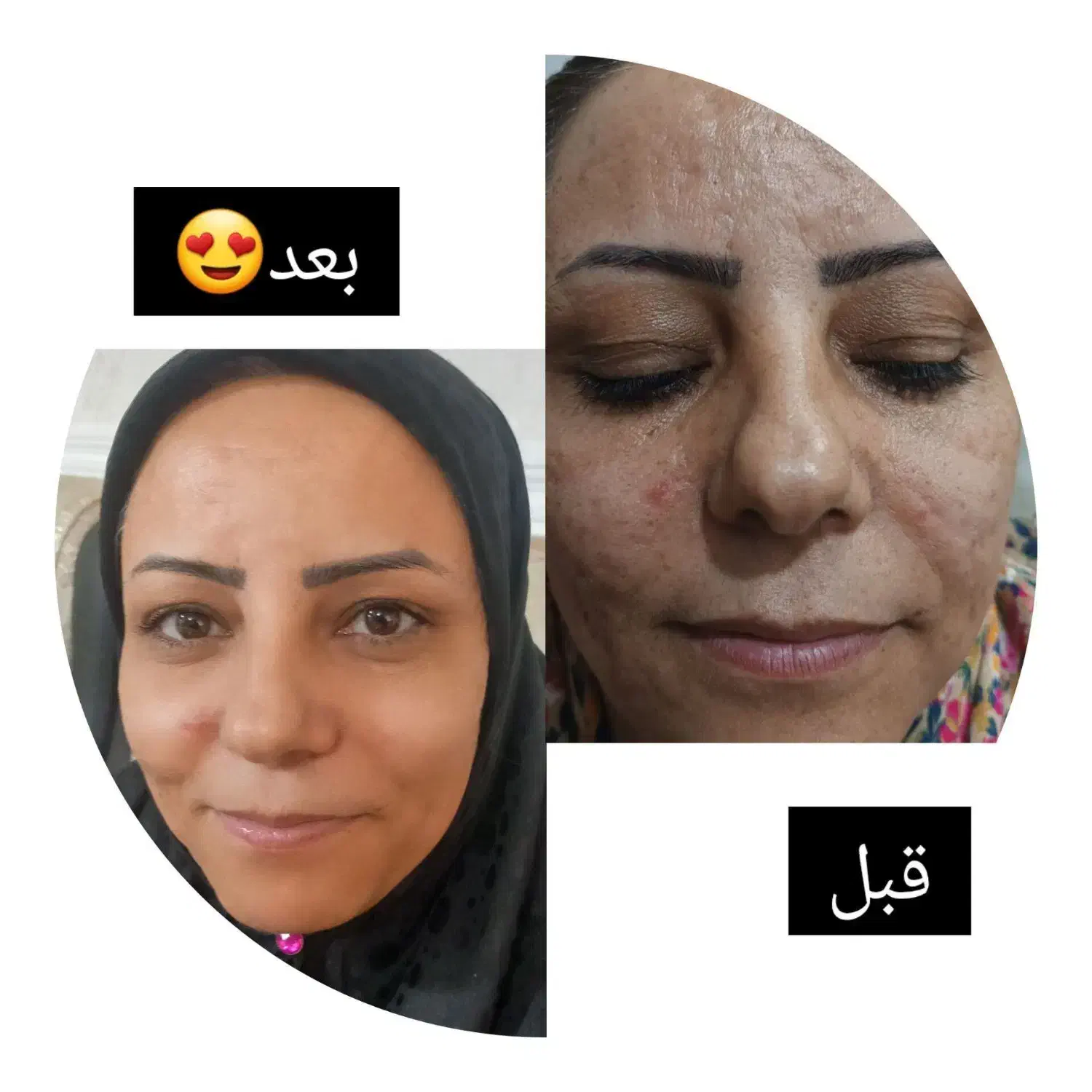 مشاور پوست و مو|آرایشی، بهداشتی، درمانی|قم, وادی السلام|دیوار