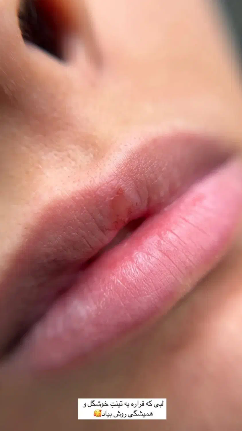 مدل تینت لب روسی|خدمات آرایشگری و زیبایی|کرج, کوی مهر|دیوار