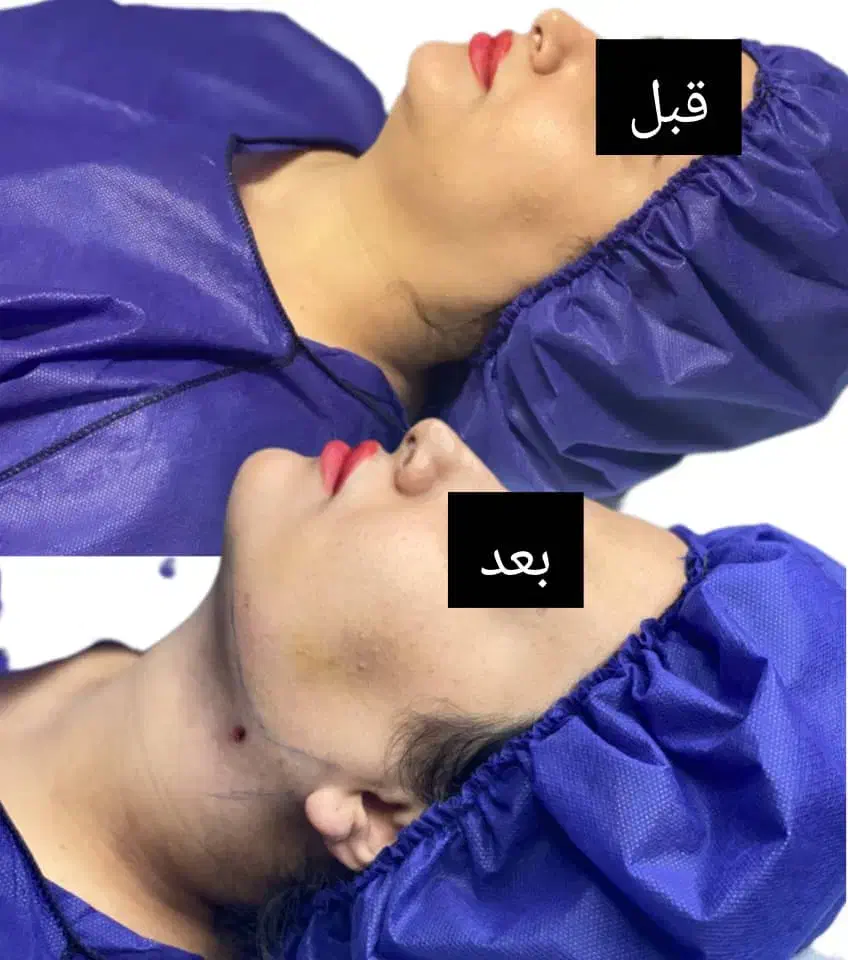 ساکشنغبغب|خدمات آرایشگری و زیبایی|یاسوج, |دیوار