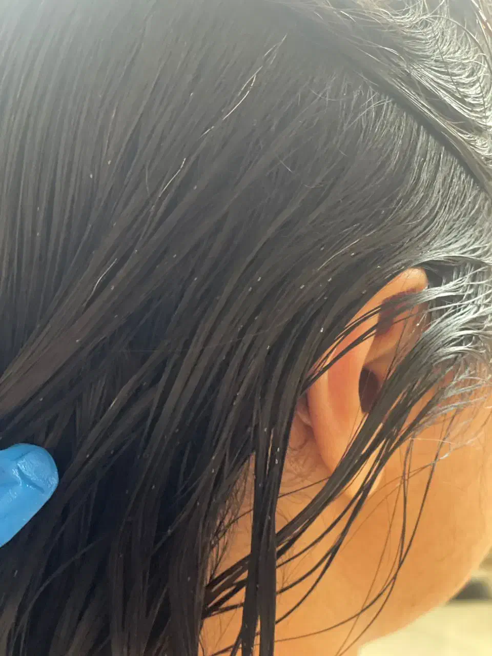 درمان قطعی رشک و شپش باکمترین هزینه|خدمات آرایشگری و زیبایی|اسلامشهر, شهرک قائمیه|دیوار