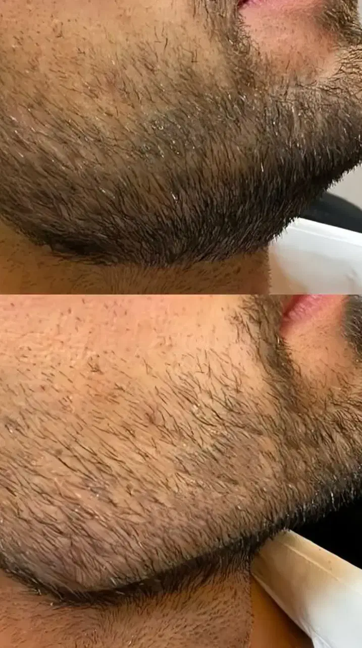 جشنواره پاییزه کلیه ی خدمات زیبایی کلینیک راز|خدمات آرایشگری و زیبایی|قم, شهرک قدس|دیوار