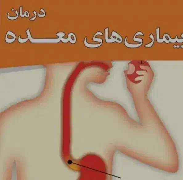 درمان سردی معده.رفلاکس.ترش کردن زخم معده و..|آرایشی، بهداشتی، درمانی|گرگان, |دیوار