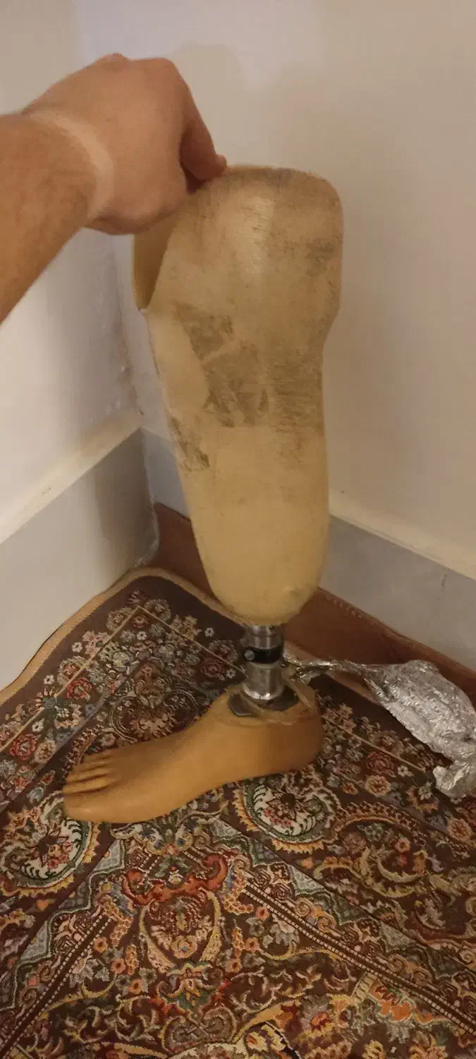 فروش پا مصنوعی پروتزی فولادی در حد نو|پزشکی|اهواز, کوی مهدیس|دیوار