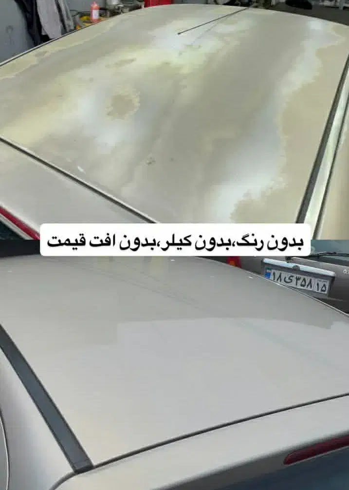 واکسپولیشرفعآفتابسوختگی لیسهگیری سرامیکvip|خدمات موتور و ماشین|تبریز, |دیوار
