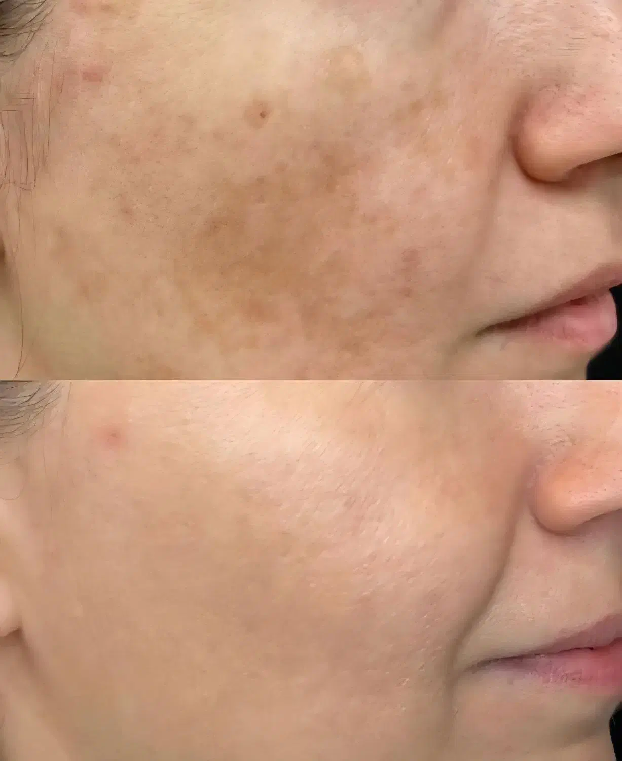 کرم ضدلک لاکچری کوین|آرایشی، بهداشتی، درمانی|هشتگرد, شهرک راه آهن|دیوار