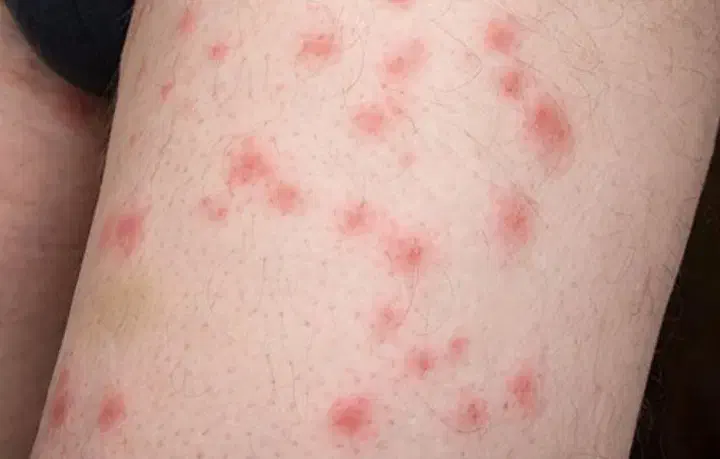 خدمات تخصصی و%100 تضمینی سمپاشی|خدمات نظافت|تهران, جمهوری|دیوار