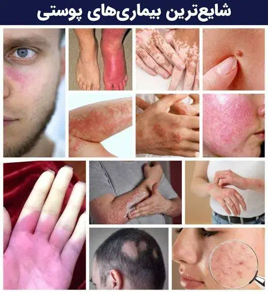 درمان بیماری های پوستی|آرایشی، بهداشتی، درمانی|شیراز, باغ تخت|دیوار