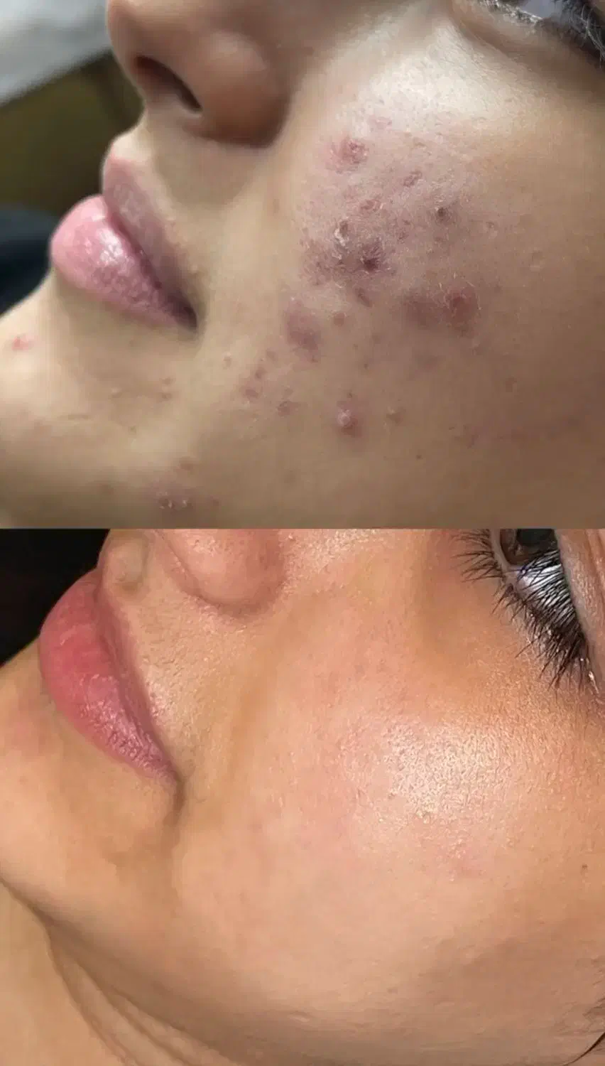 آموزش فیشیال پاکسازی پوست تخفیف بلک فرایدی|خدمات آموزشی|کرمانشاه, |دیوار