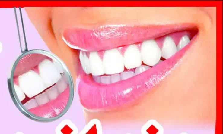 کامپوزیت  ( دندانپزشکی آسمان)|خدمات آرایشگری و زیبایی|تهران, دریاچه شهدای خلیج فارس|دیوار