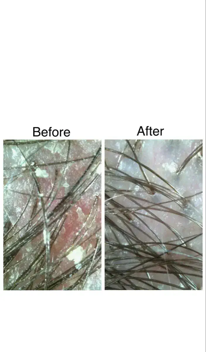 آموزش تخصصی اسکراب اسکالپ مو با ۵۰ درصد تخفیف|خدمات آموزشی|ارومیه, |دیوار