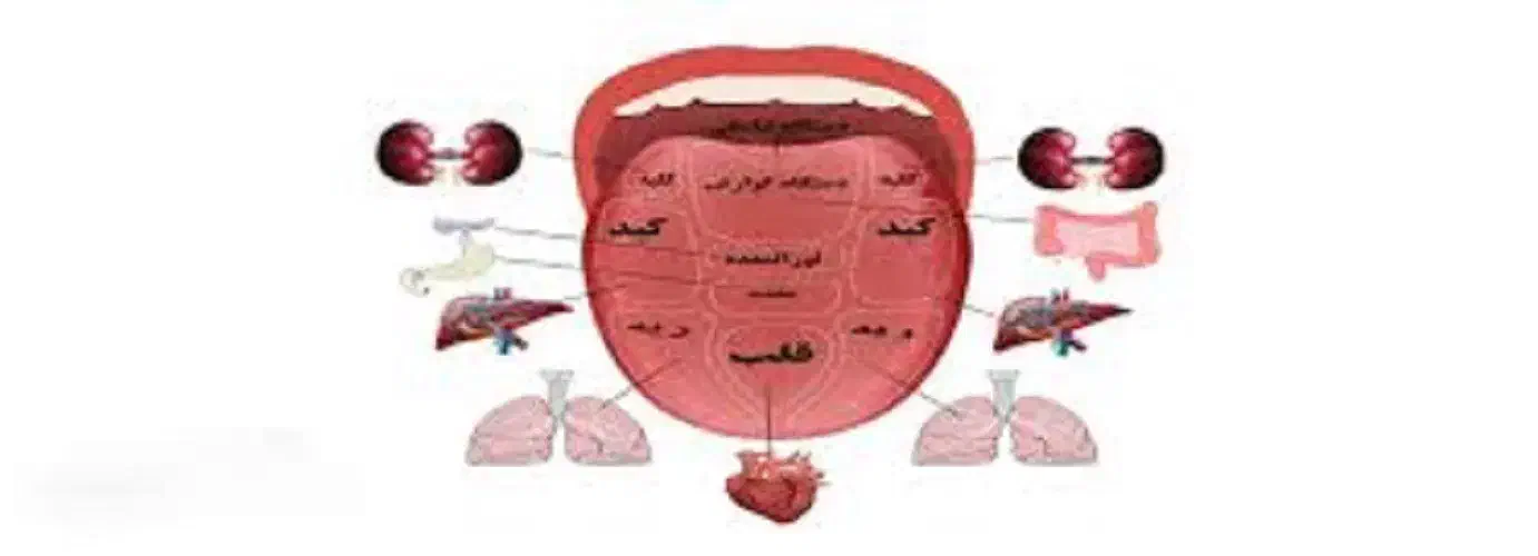 آموزش زبان شناسی ( تشخیص بیماری از روی زبان )|خدمات آموزشی|تهران, تهرانسر مرکزی|دیوار