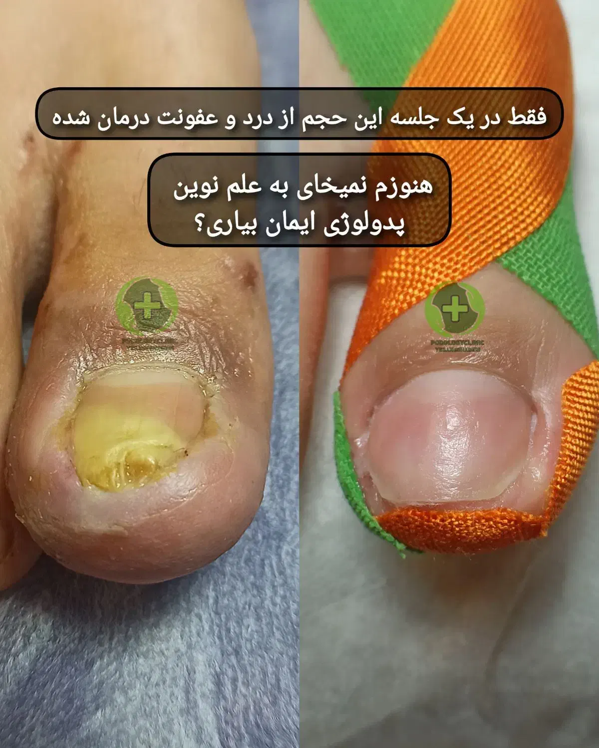 درمان بیماری های ناخن بدون جراحی درکلینیک|خدمات آرایشگری و زیبایی|ورامین, خیر آباد|دیوار