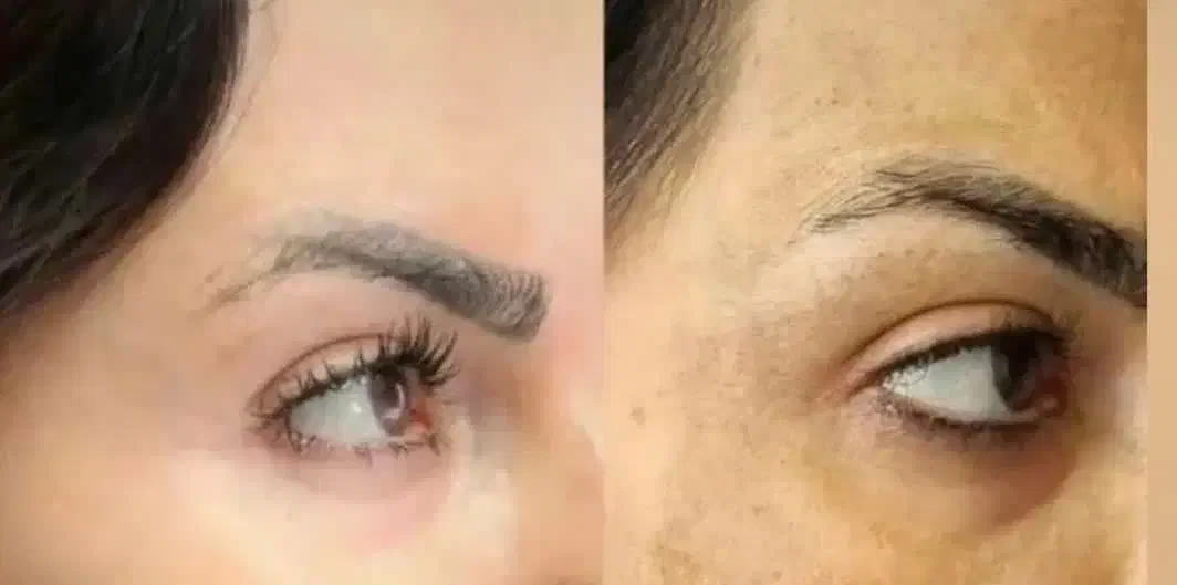 با تیرگی خداحافظی کن|آرایشی، بهداشتی، درمانی|رشت, پسیخان|دیوار