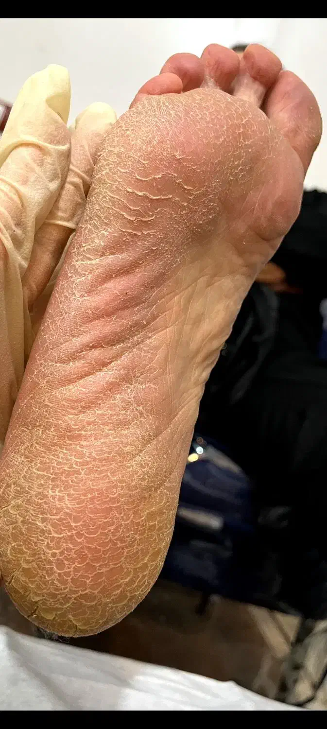 پدیکور فقط ۳۵۰|خدمات آرایشگری و زیبایی|ایذه, |دیوار