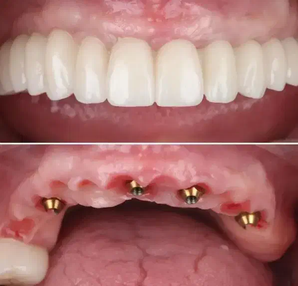 اقساط یک ساله|مصالح و تجهیزات ساختمان|تبریز, |دیوار