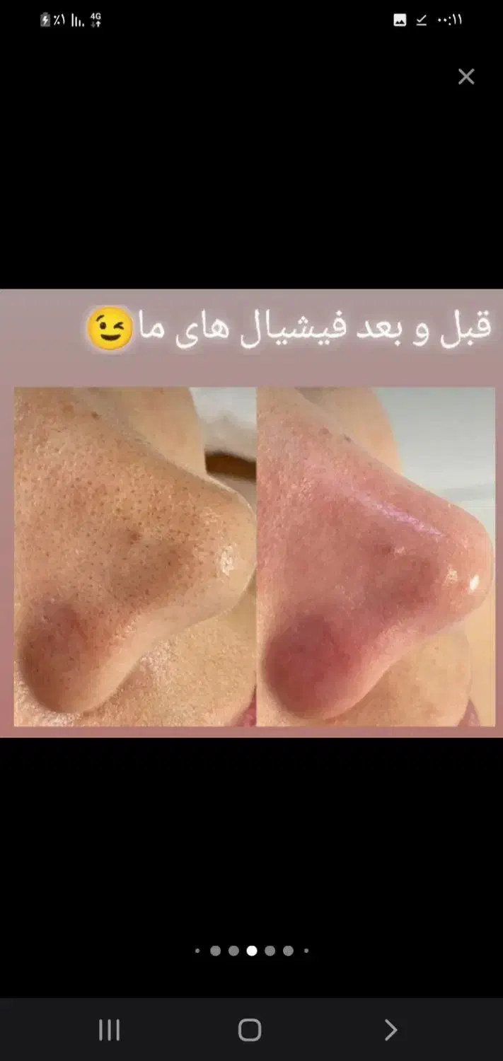 فیشیال تخصص و پدیکور و جوان سازی دست|خدمات آرایشگری و زیبایی|سرپل ذهاب, |دیوار