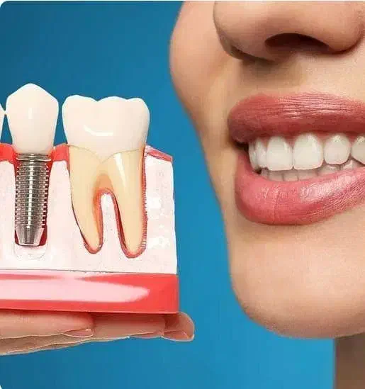 ثبت نام بیمه دندانپزشکی و کامپوزیت طلایی شو|خدمات آرایشگری و زیبایی|گرگان, |دیوار