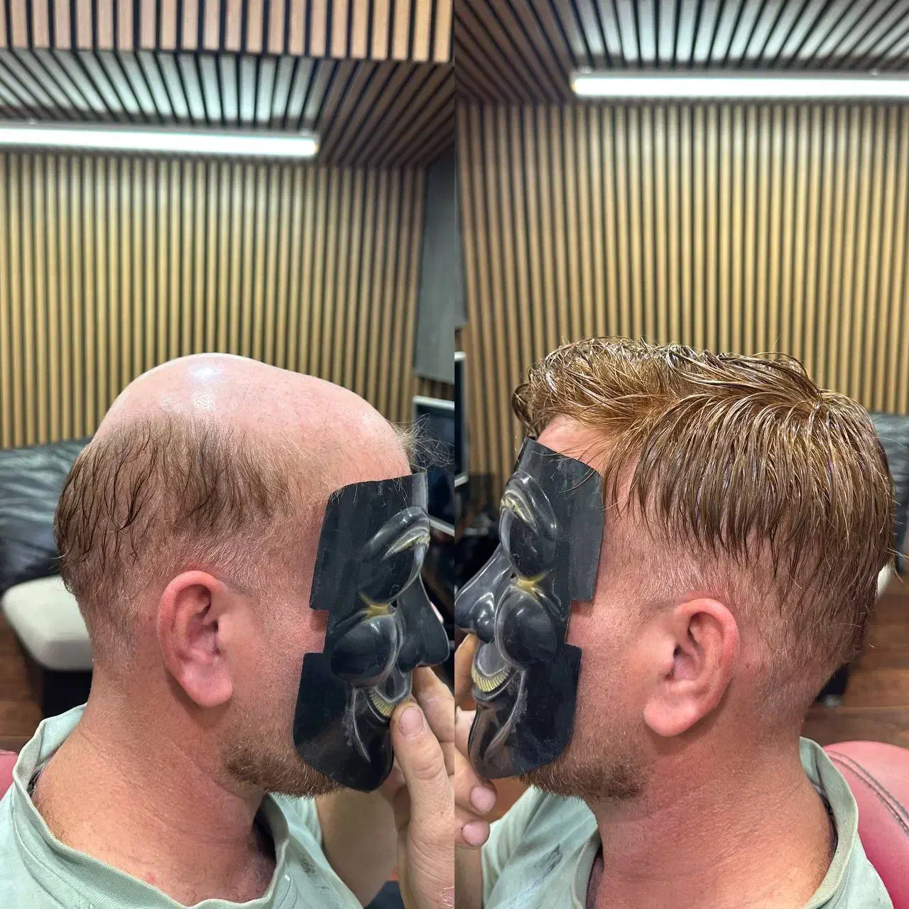 پروتزمو قم|خدمات آرایشگری و زیبایی|قم, زاد|دیوار