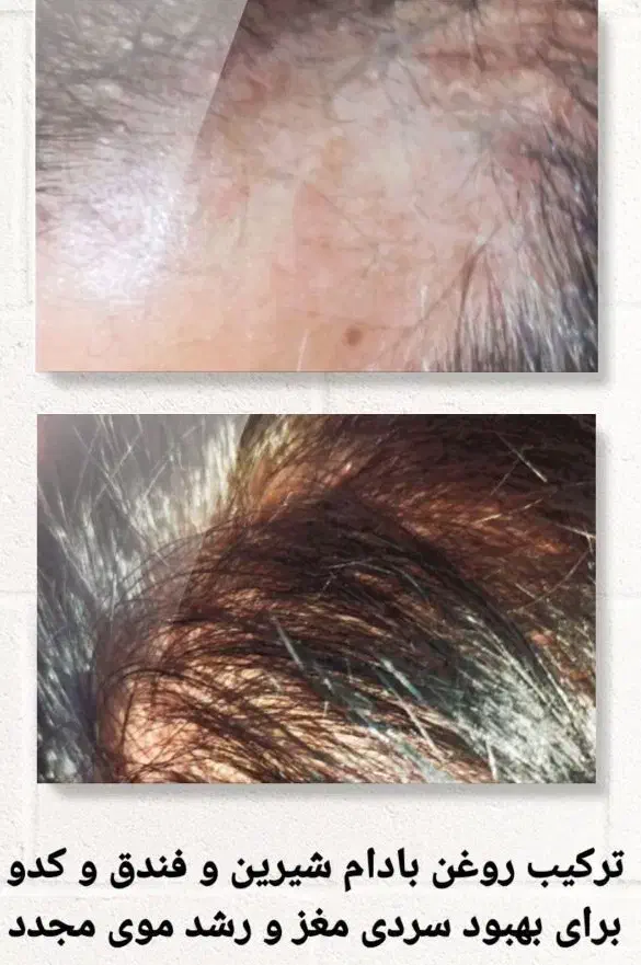 محصولات شرکت نیوشانیک|آرایشی، بهداشتی، درمانی|تهران, شهرک امام خمینی|دیوار