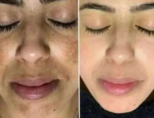 مشاوره درمانی رایگان|فعالیت داوطلبانه|کرمانشاه, |دیوار