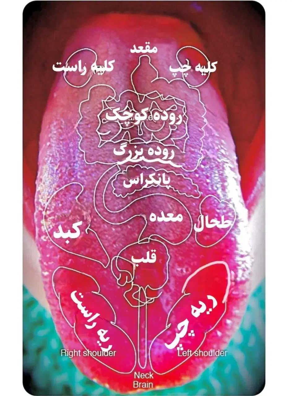 اسکن دقیق بدن ازروی زبان|خدمات پیشه و مهارت|آبعلی, |دیوار