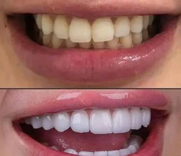 دندانپزشکی|خدمات آرایشگری و زیبایی|کرمان, |دیوار