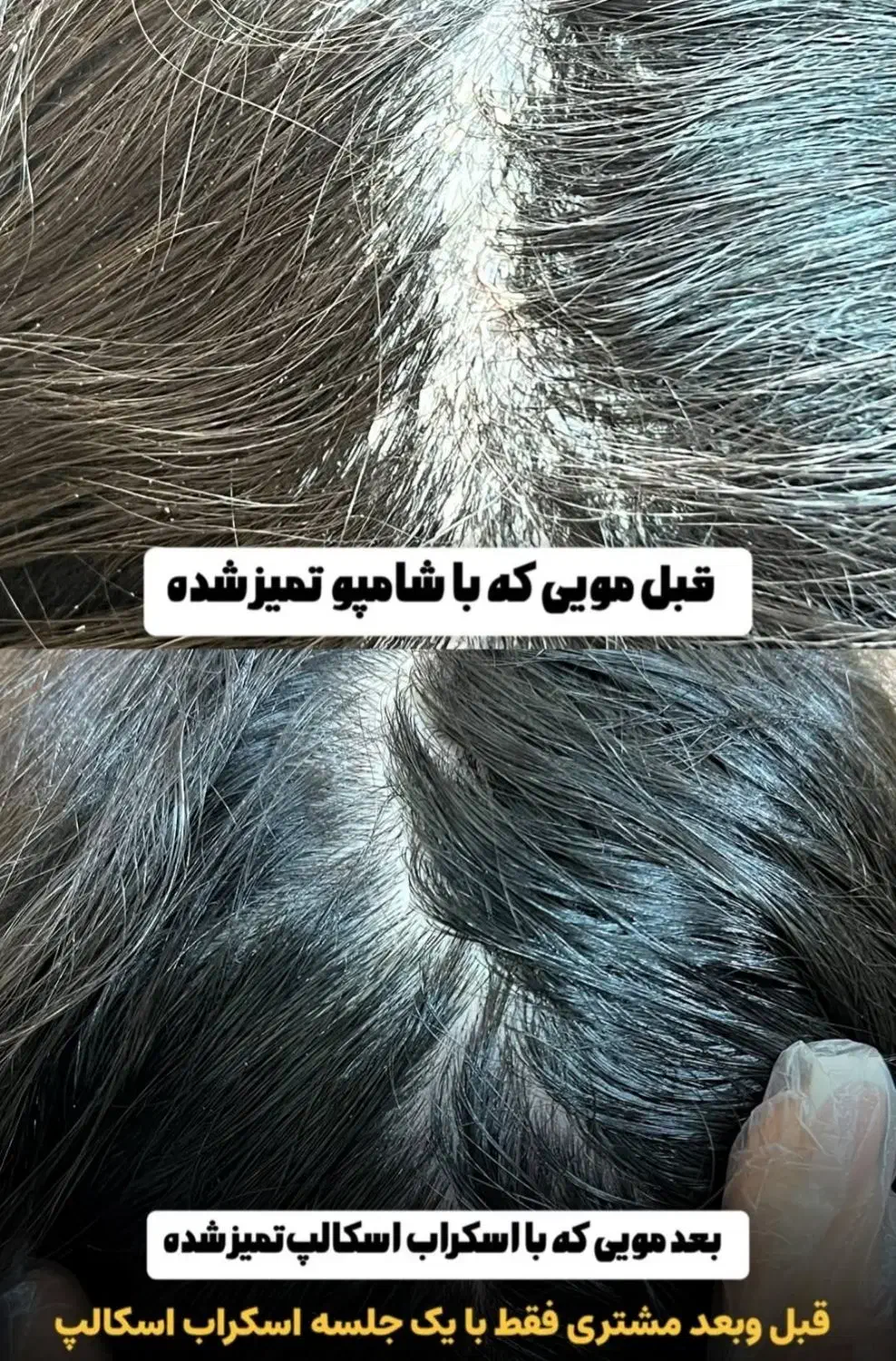 اسکراب اسکالپ تخصصی|خدمات آرایشگری و زیبایی|محمودآباد, |دیوار