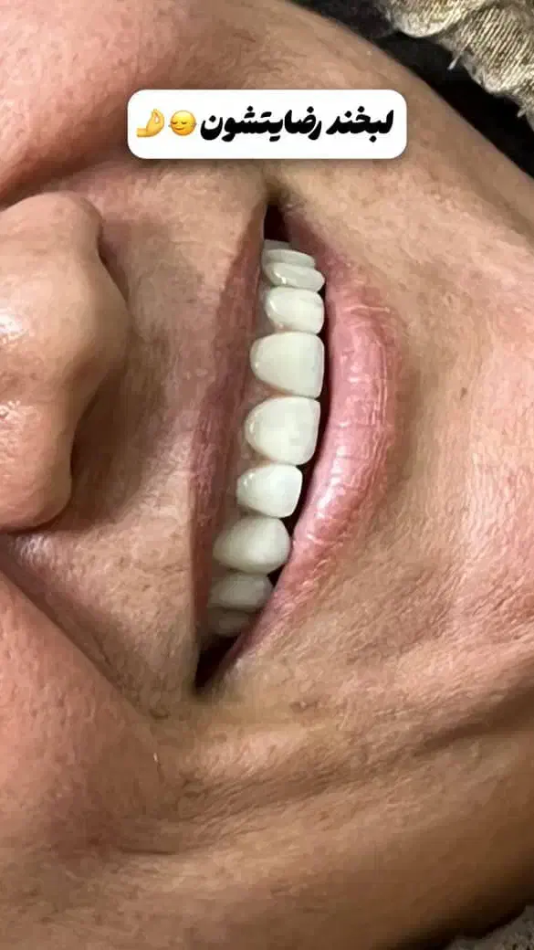 جشنواره کامپوزیت واحدی 1500ت با طرح طلابی شو|خدمات آرایشگری و زیبایی|گرگان, |دیوار